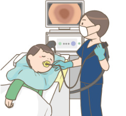 上部消化管内視鏡検査（胃カメラ）のイラスト