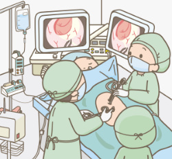 腹腔鏡下胆のう摘出術のイラスト