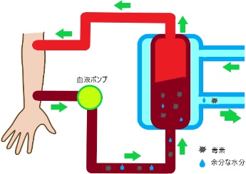 血液透析のイラスト